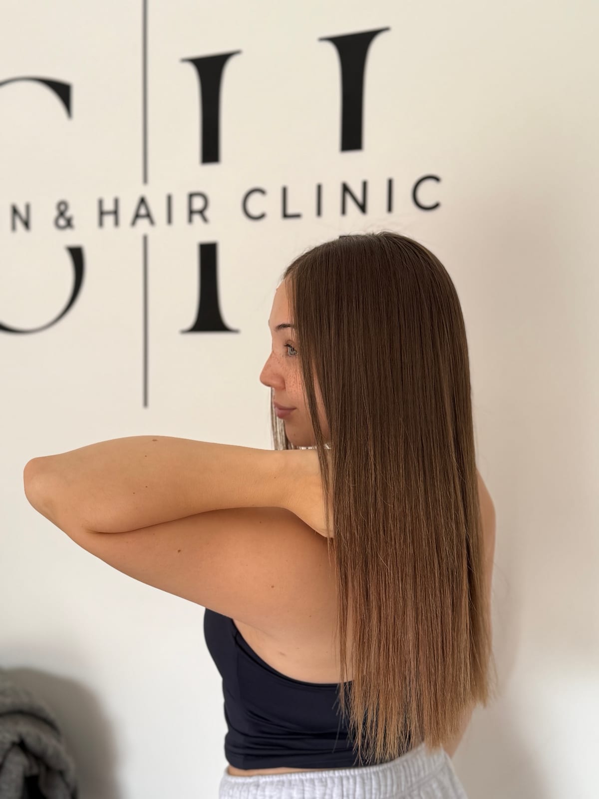 Sleek, smooth Nanoplasty result at Skiin & Hair Clinic